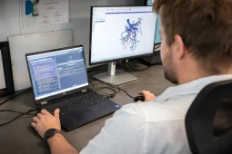 Ve FN Ostrava umí lékaři díky umělé inteligenci vizualizovat cévy tlustého střeva