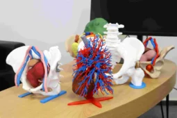 Ostravští lékaři využívají před komplikovanými operacemi 3D modely orgánů a kostí