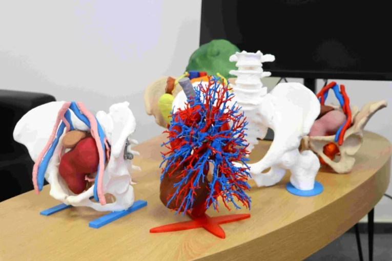 Ostravští lékaři využívají před komplikovanými operacemi 3D modely orgánů a kostí