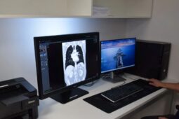Revoluce v benešovské nemocnici. Špičková počítačová tomografie zkracuje vyšetření a šetří pacienty