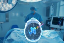 Pacienti v českobudějovické nemocnici získají přesnější péči při operacích mozku díky 3D brýlím a rozšířené realitě