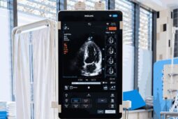 Nový ultrazvuk zrychlí vyšetření pacientů na kladenském urgentu
