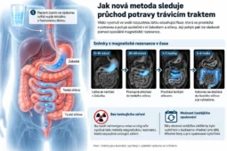 Pražští vědci chtějí sledovat trávení bez rentgenového záření. Novou metodu vyzkoušeli na zvířatech