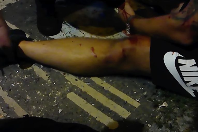 Dopravní nehoda Olomouc